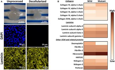 Extracellular Matrix Disparities in an Nkx2-5 Mutant Mouse Model of Congenital Heart Disease